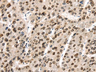 TUSC5 Antibody