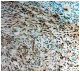 TWIST1 Antibody