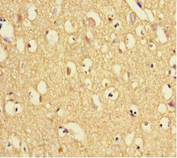 TXNDC9 Antibody