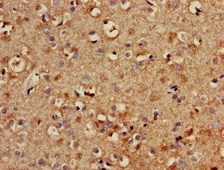 TYRO3 Antibody