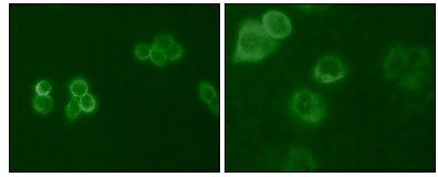 Tyro3 Antibody