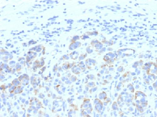 TYRP1 Antibody