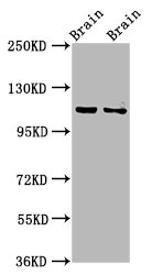 CLIP2 Antibody
