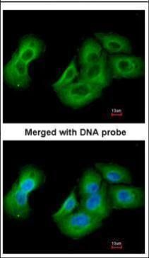 UAP1 Rabbit Polyclonal Antibody