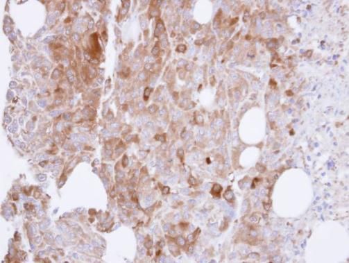 UAP1 Rabbit Polyclonal Antibody