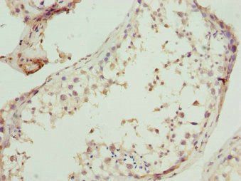 UBA3 Antibody