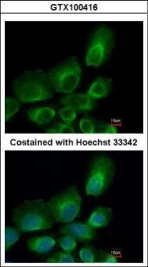 UBE2B Rabbit Polyclonal Antibody