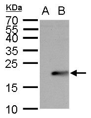 UBE2B Rabbit Polyclonal Antibody