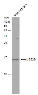 UBE2B Rabbit Polyclonal Antibody