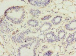 UBE2D1 Antibody