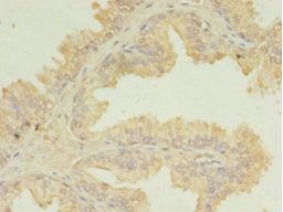 UBE2D1 Antibody