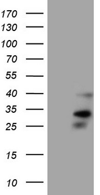 UBE2D2 Antibody