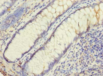 UBE2G2 Antibody