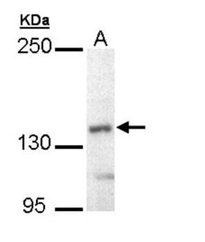 UBE4B antibody