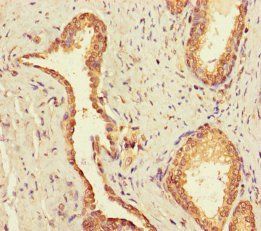 UBE2Q2 Antibody