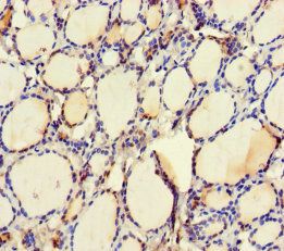 UBE2Q2 Antibody