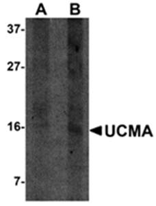 UCMA Rabbit Polyclonal Antibody