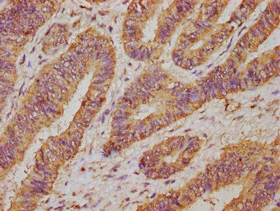 UCP2 Antibody