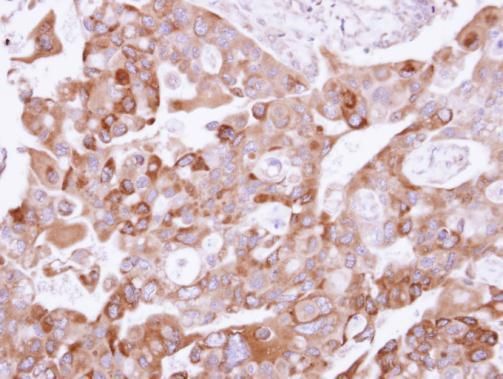 UFD1L Rabbit Polyclonal Antibody