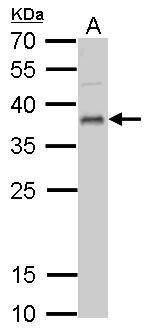 UFD1L Rabbit Polyclonal Antibody