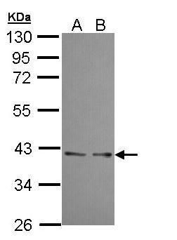 UFD1L Rabbit Polyclonal Antibody