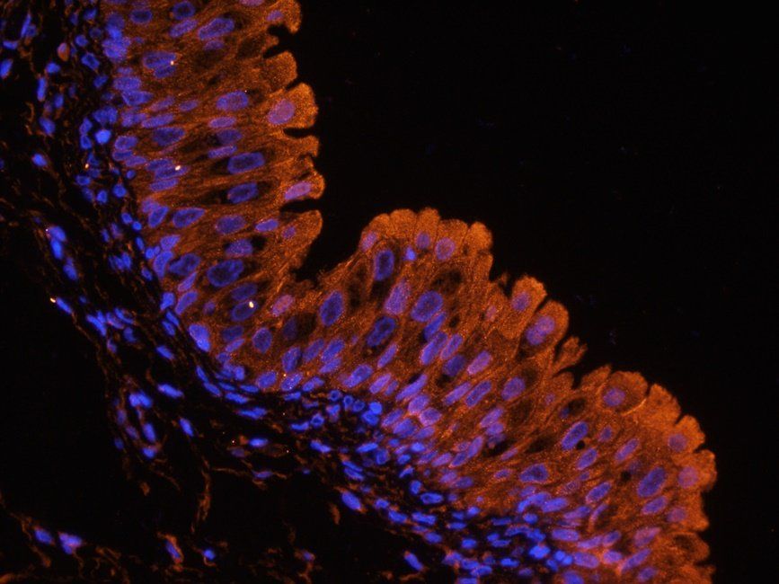 UGT1A1 Rabbit Polyclonal Antibody