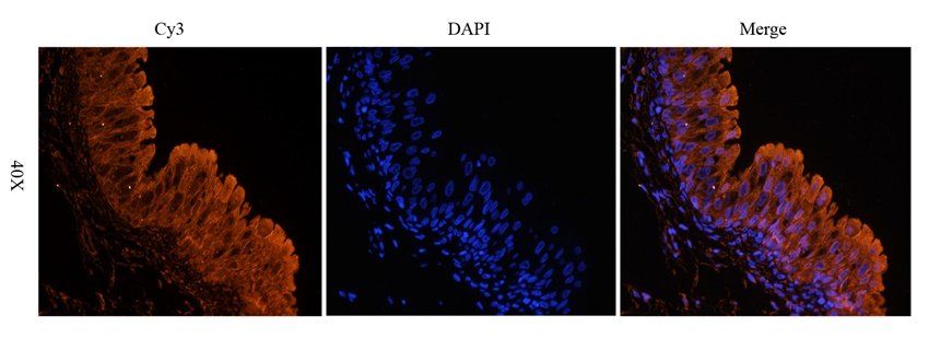 UGT1A1 Rabbit Polyclonal Antibody
