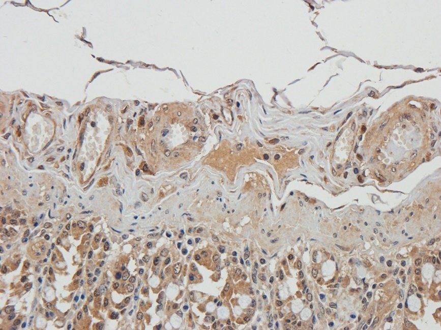 UGT1A1 Rabbit Polyclonal Antibody