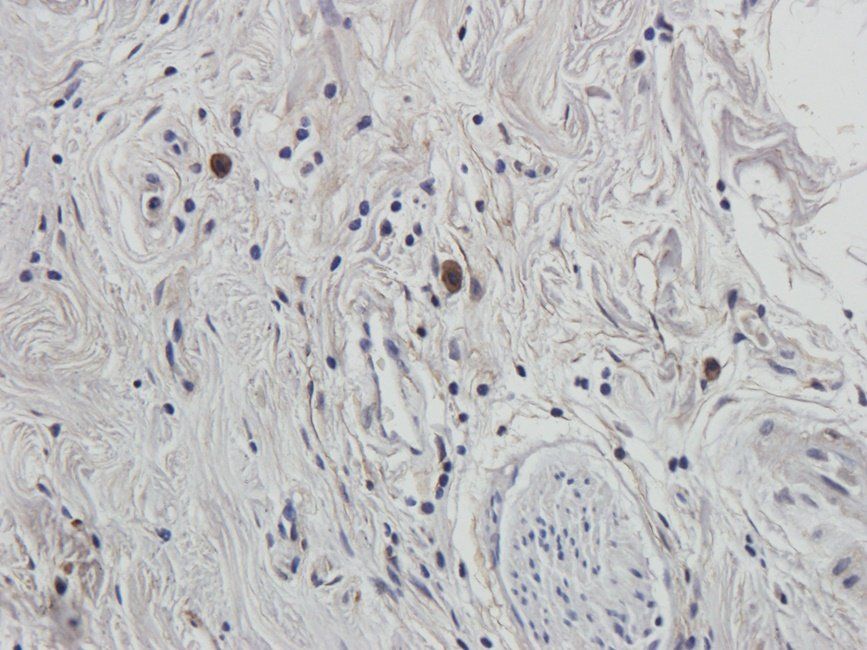 UGT1A1 Rabbit Polyclonal Antibody