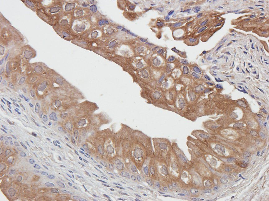 UGT1A1 Rabbit Polyclonal Antibody