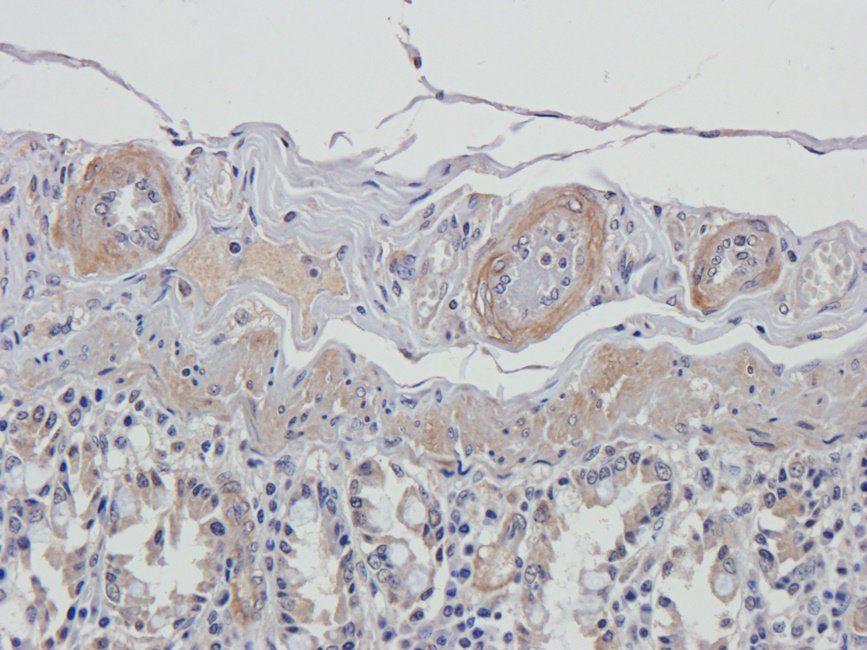 UGT1A1 Rabbit Polyclonal Antibody