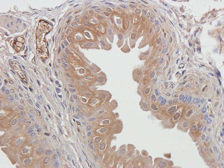 UGT1A1 Rabbit Polyclonal Antibody
