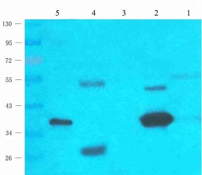 UGT1A1 Rabbit Polyclonal Antibody