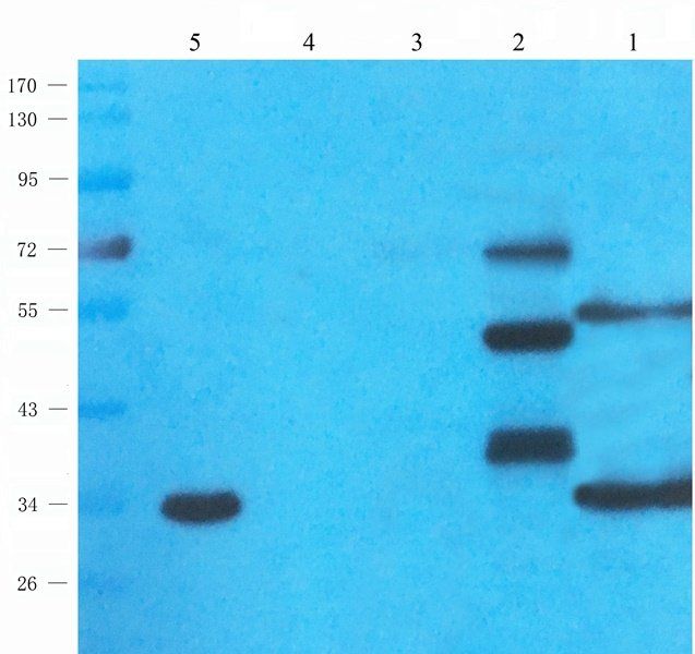 UGT1A1 Rabbit Polyclonal Antibody