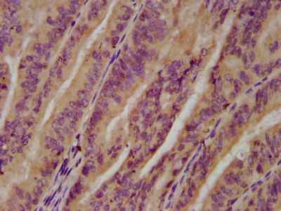 UGT1A6 Antibody