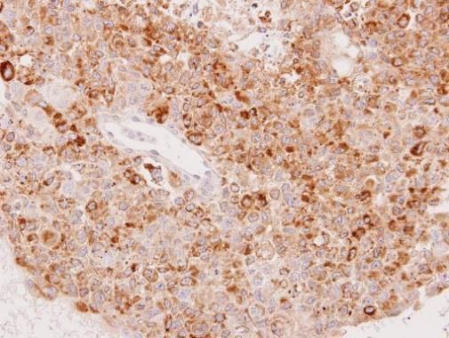 UGT1A6 Rabbit Polyclonal Antibody