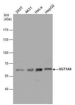 UGT1A6 Rabbit Polyclonal Antibody