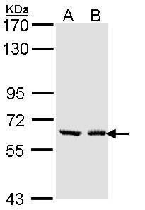 UGT1A6 Rabbit Polyclonal Antibody