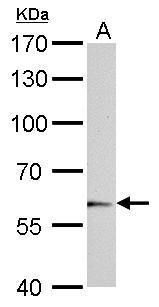 UGT1A6 Rabbit Polyclonal Antibody