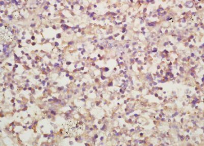 ULBP2 Rabbit Polyclonal Antibody
