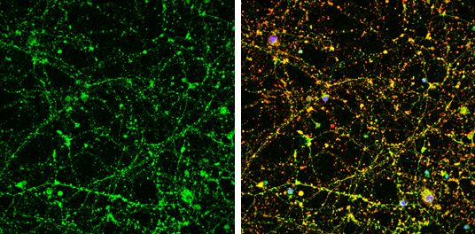 UNC13B Rabbit Polyclonal Antibody