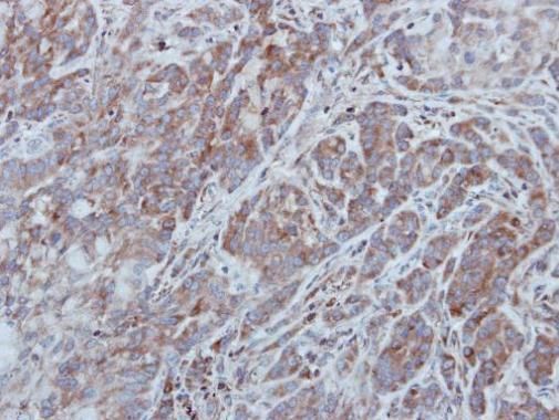 UNC13B Rabbit Polyclonal Antibody