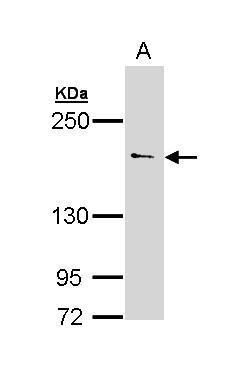 UNC13B Rabbit Polyclonal Antibody