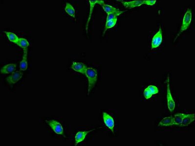 UNG Antibody