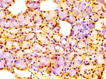 URI1 Antibody