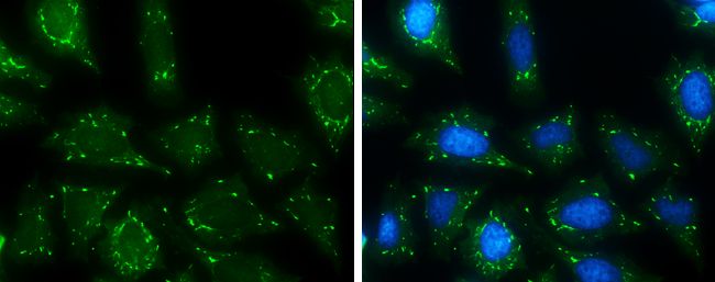 USP15 Rabbit Polyclonal Antibody