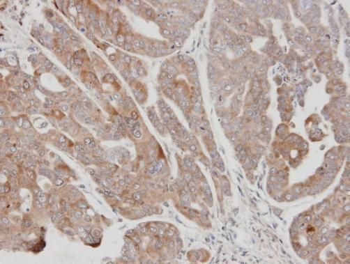 USP15 Rabbit Polyclonal Antibody