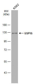 USP15 Rabbit Polyclonal Antibody