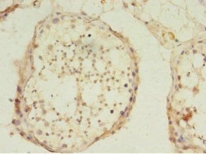 USP45 Antibody