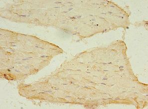 USP45 Antibody